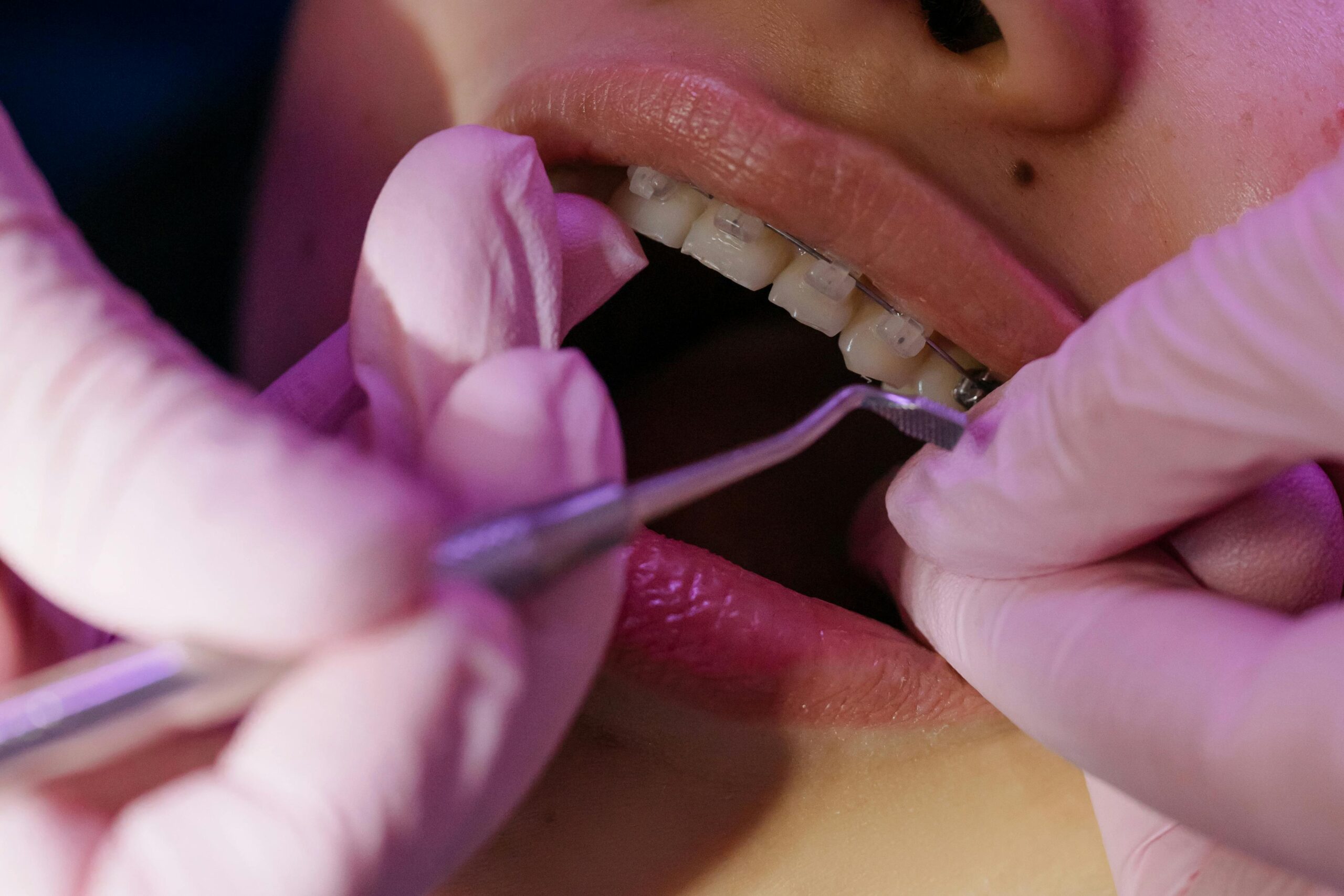 orthodontic treatments in Charlotte